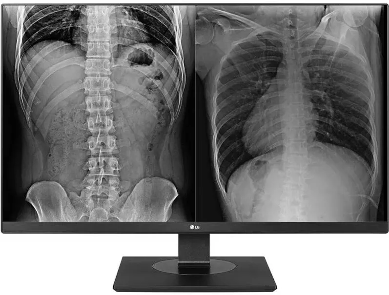 Monitor LG 27HJ713C-B 27 inch UHD IPS 5 ms 60 Hz