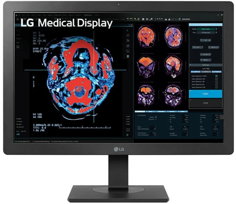 Monitor LG 24" 24HR513C-B.AEU